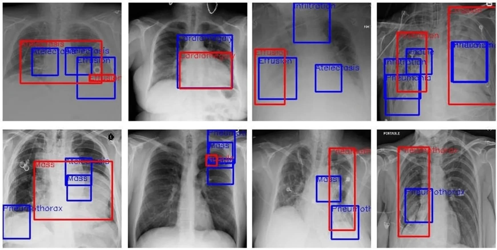 Medical Data Annotation - Professional data annotation service showing AI training process and machine learning algorithms